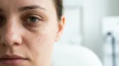 Wie du Augenringe ohne teure Cremes loswirst – 7 einfache Expertentipps